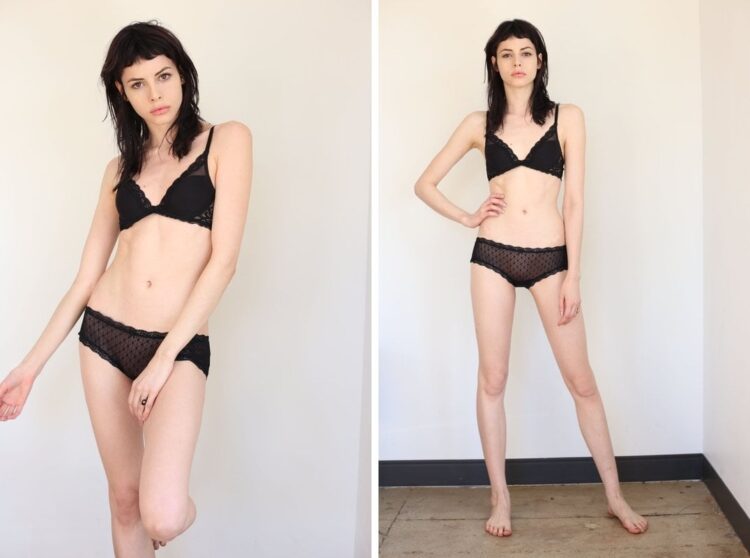 Hot Sexy Charlotte Kemp Muhl Bikini Pics