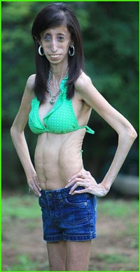 Lizzie Velasquez 6