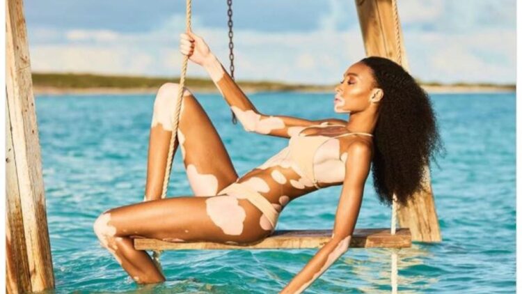 Winnie Harlow 10