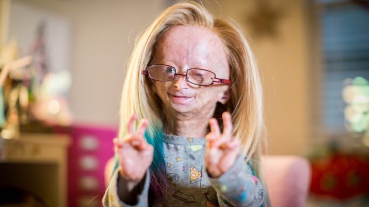 adalia rose 2