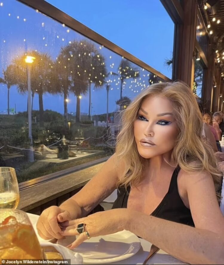 jocelyn wildenstein 4