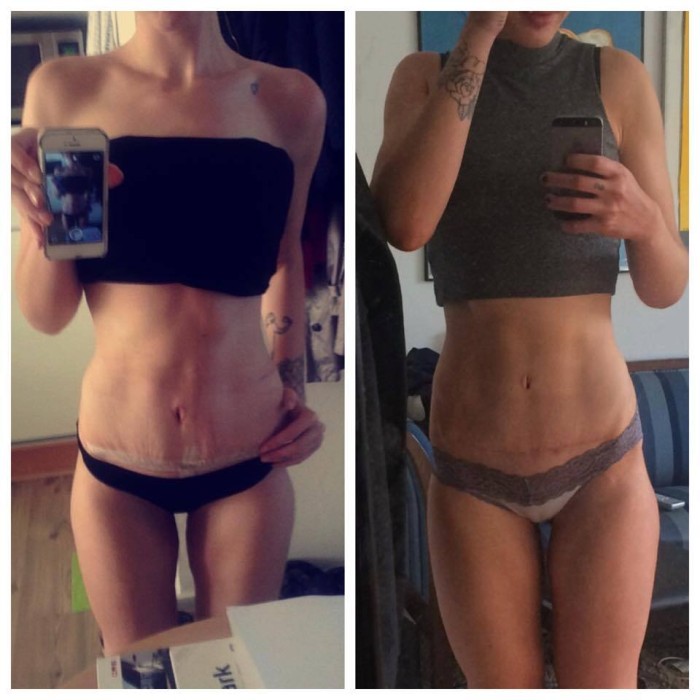 mathilde h. broberg 2