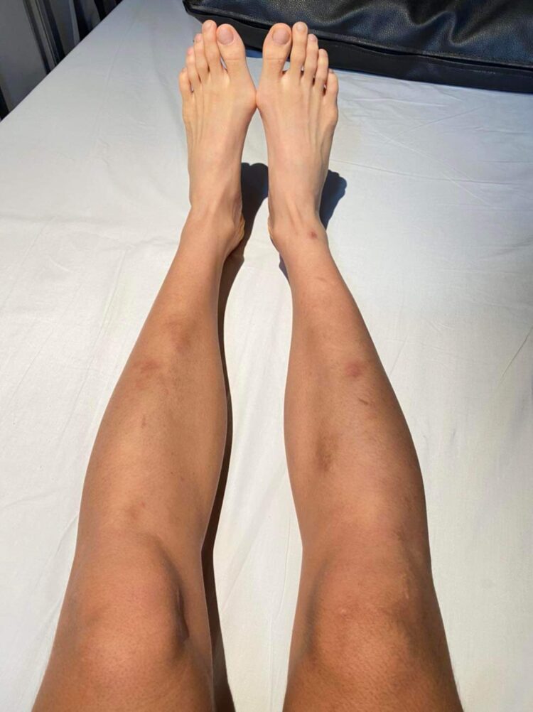 panipak wongpattanakit 9