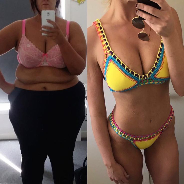 simone anderson pretscherer