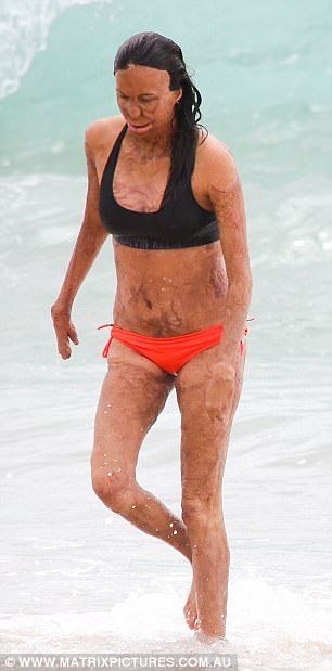 turia pitt 3