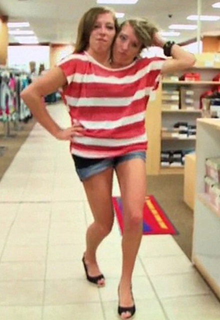 abigail hensel feet 2