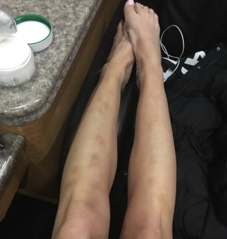 alison wonderland feet