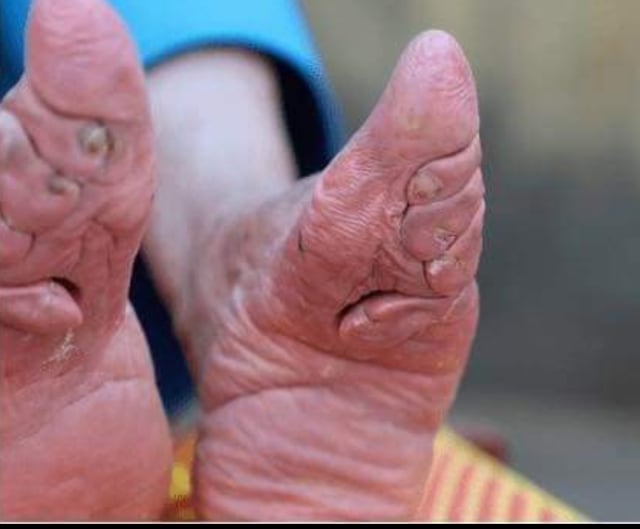 asian beauty secrets feet 6