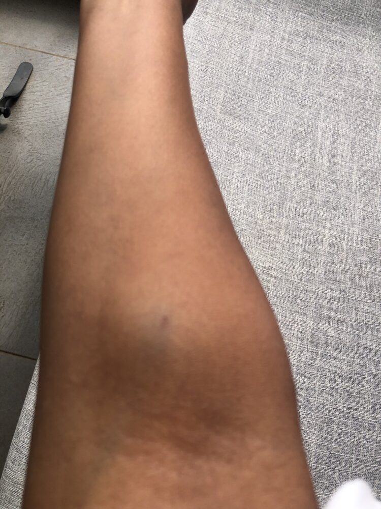 asma ninin kurnia feet 5