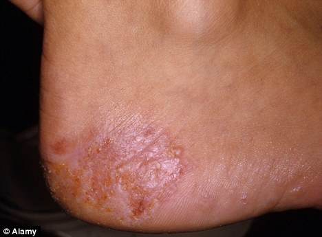 atiyana crawley feet 6