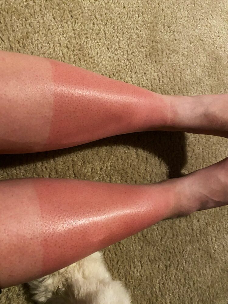 aureylian feet 1