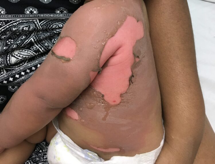 avery tirone feet 4 scaled