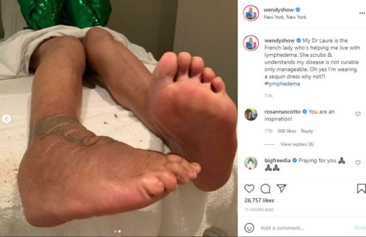 bahumi mhlongo feet 2