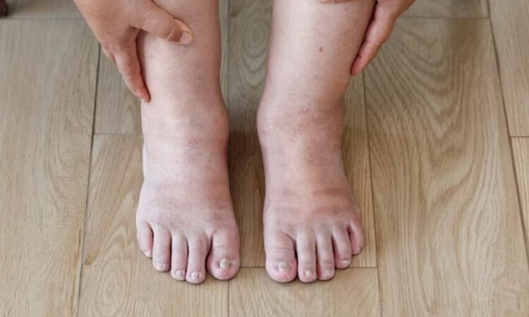 bao ly nguyen feet 1