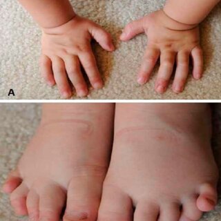 barbara krisztina opitz feet 6