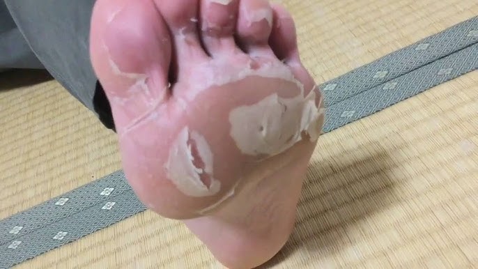 beautybyjosiek feet 6