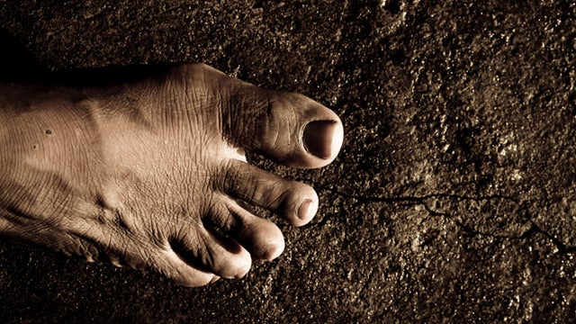 berna iskandar feet 2