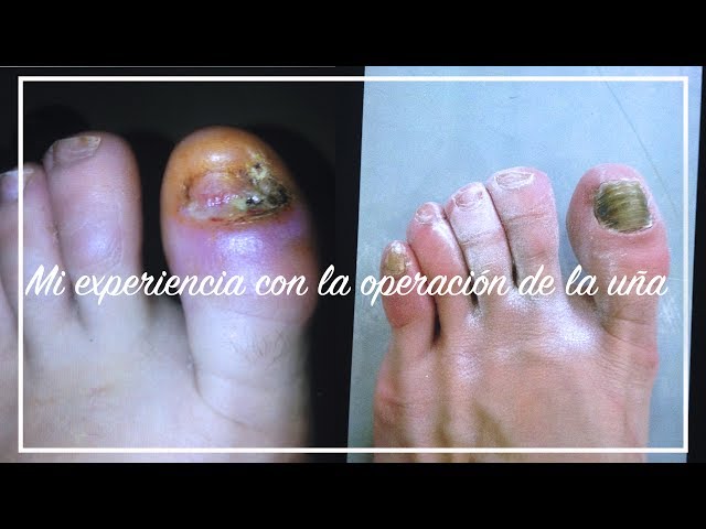 berry berryuca feet 4