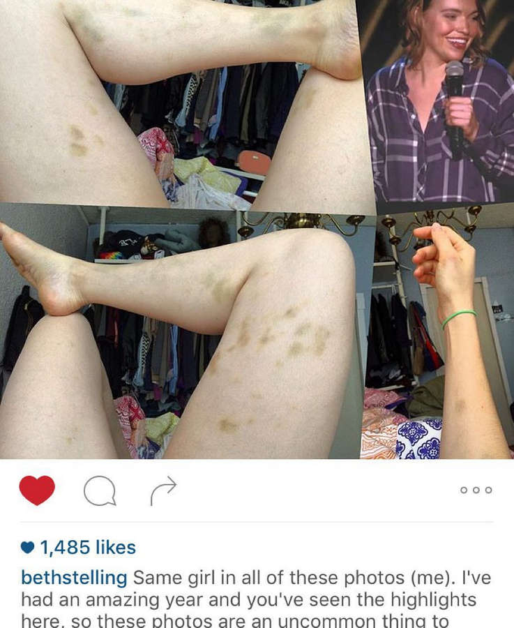 beth stelling feet 3