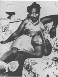 betty williams feet 5