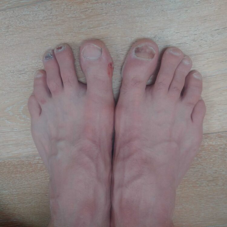 beverley turner feet scaled