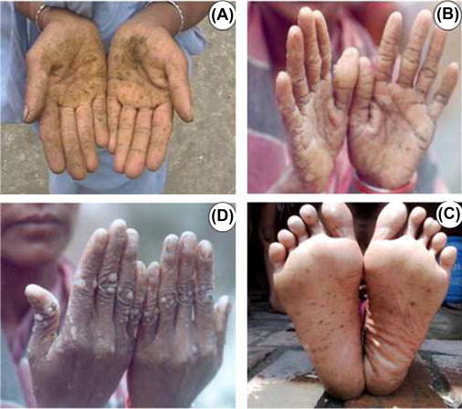 bismutharsenide feet 3