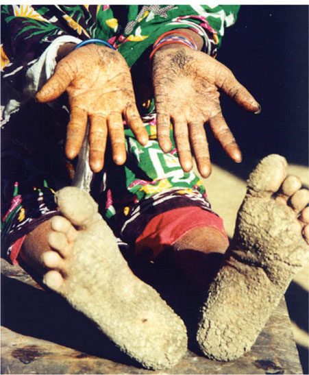 bismutharsenide feet 5