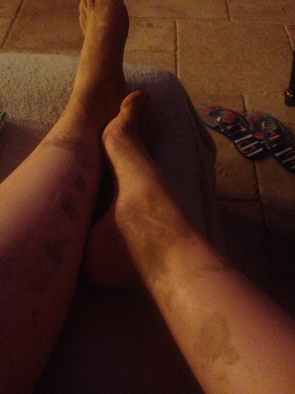 caitlin beadles feet