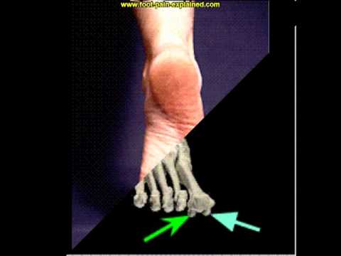 candida doyle feet 3