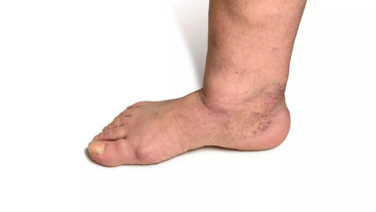 captain dangerous feet 3