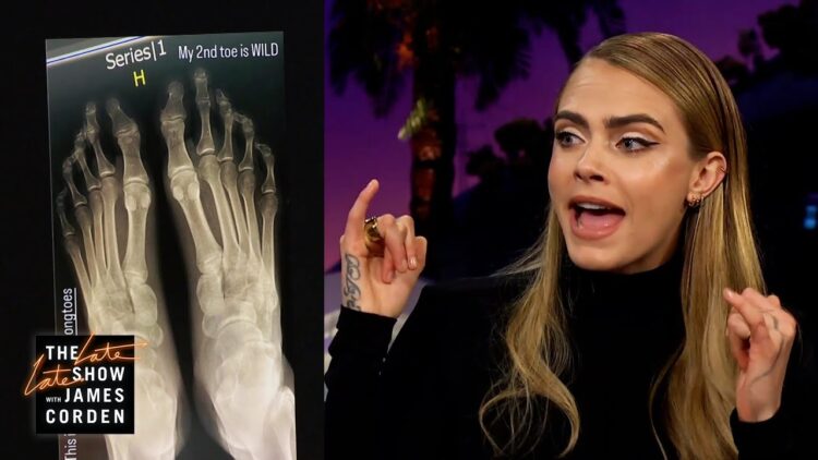 cara delevingne feet 2