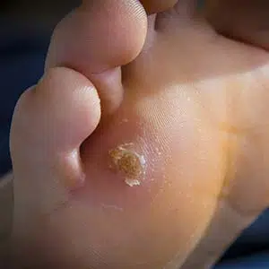 caris longoria feet 3