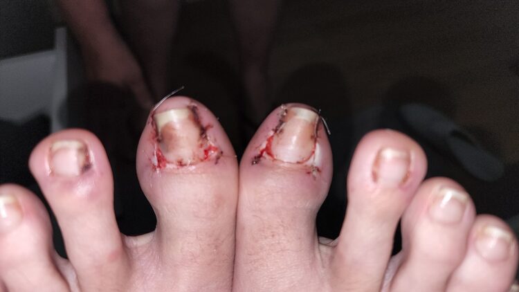 carla zambelli feet 3