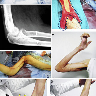 caroline galeo feet 6