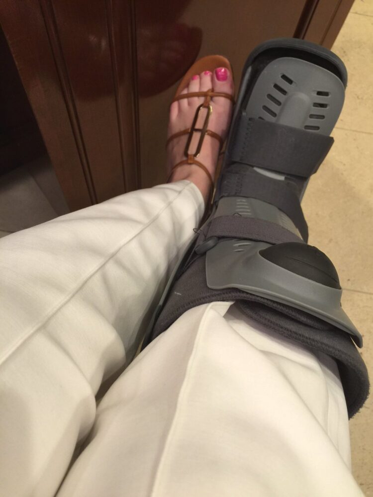 caroline manzo feet 3