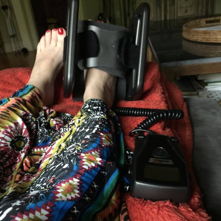 caroline manzo feet 5