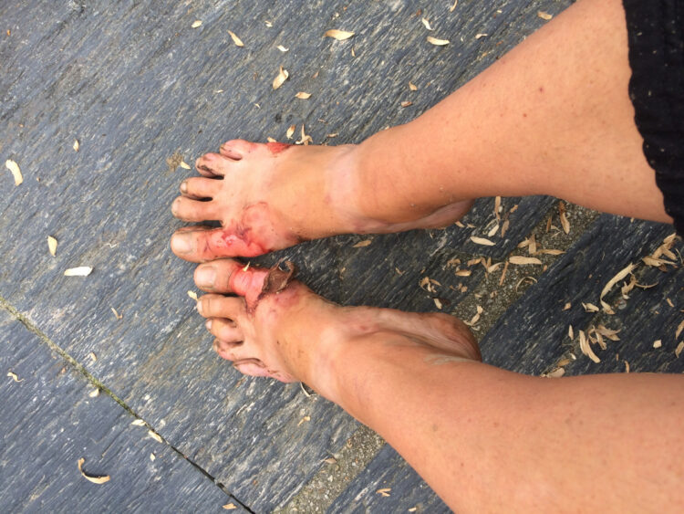 caroline presson feet 1