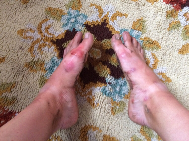 caroline presson feet 2