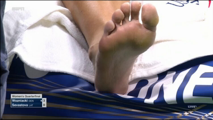 caroline wozniacki feet 2