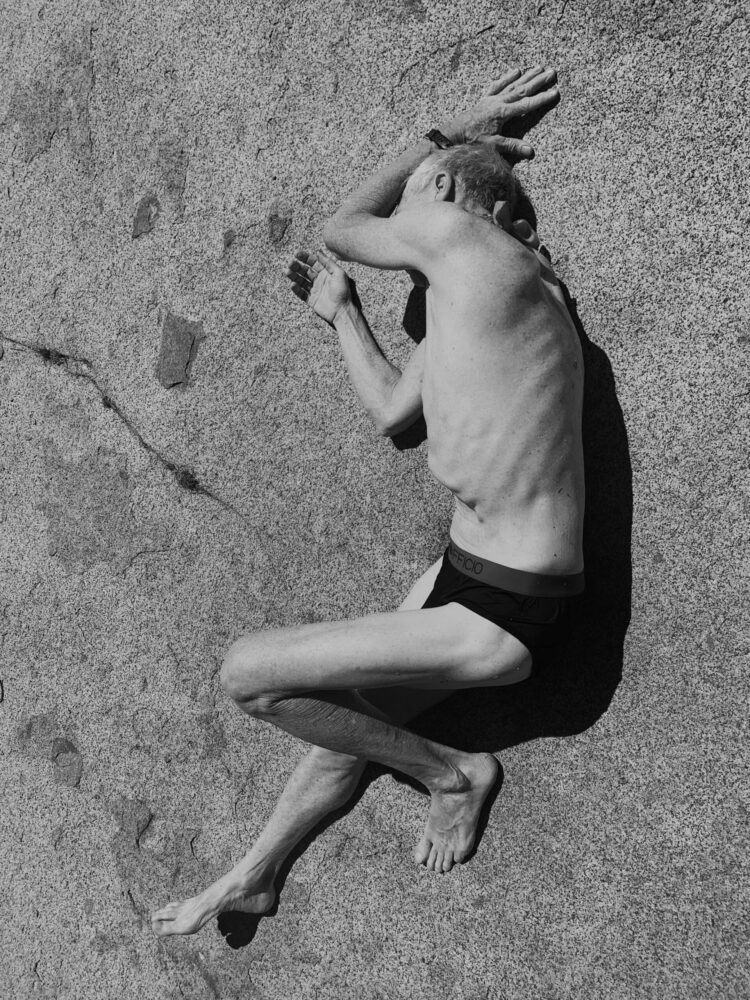 carolyn drake feet scaled