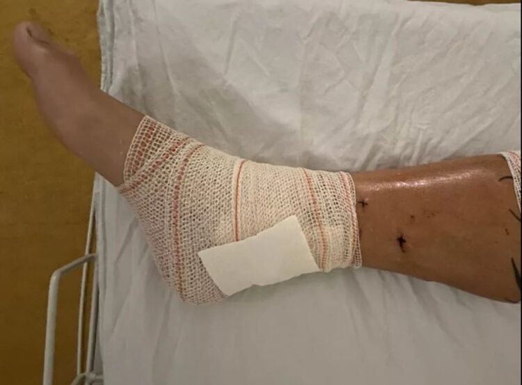 catarina jardim leitao feet 4