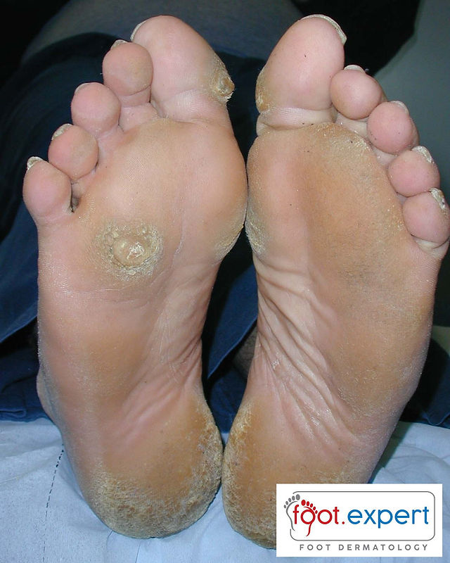 caterina fabozzi feet 2