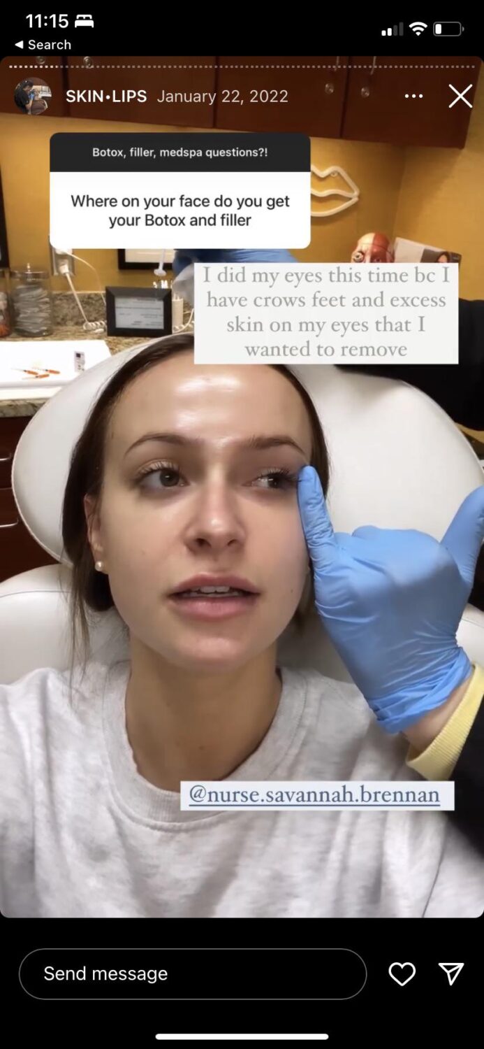 catherine ebs feet 6