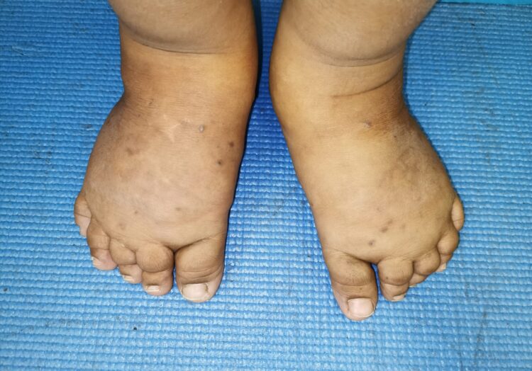 catherine lim feet 5 scaled