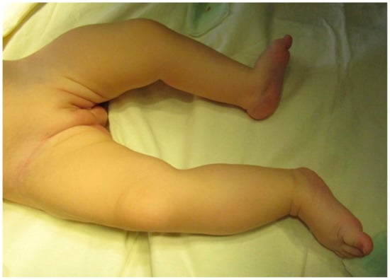 cc figueiredo feet 1