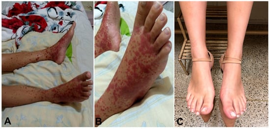 cc figueiredo feet 3