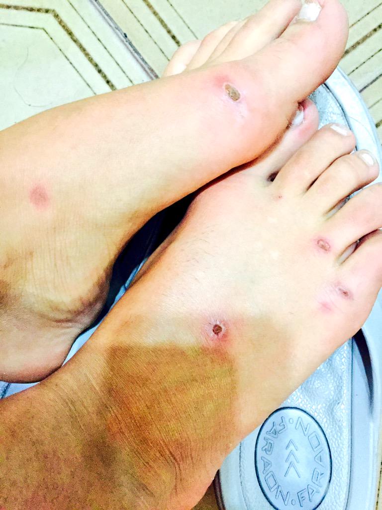 celeste muriega feet 2