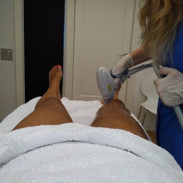 chantelle tagoe feet 5