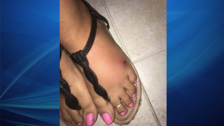 charlotte laws feet 5