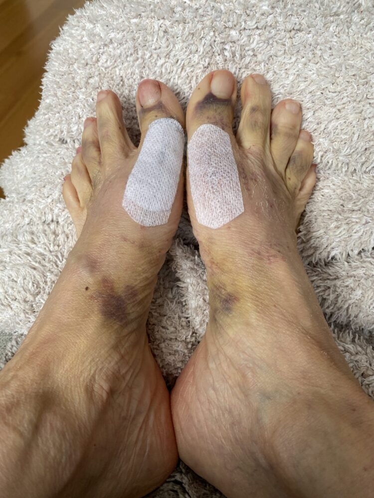 charmaine solomon feet 5 scaled